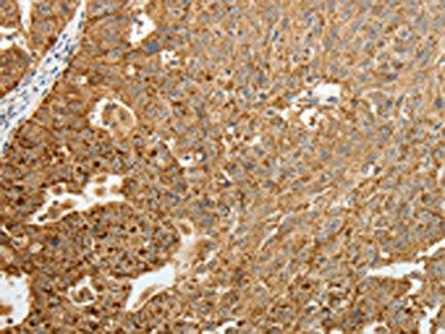 TFF2 Antibody