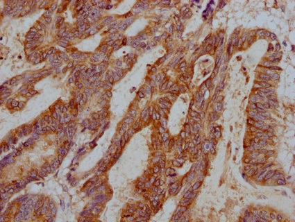 TFF3 Antibody
