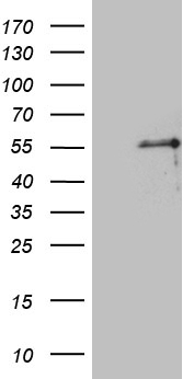 TFIIB (GTF2B) antibody