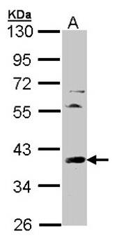 TFIID (SI) antibody