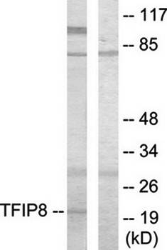 TFIP8 antibody