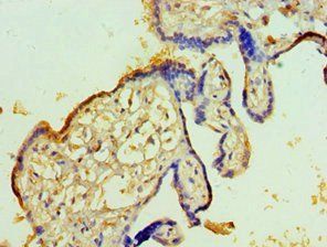 TFPI2 Antibody