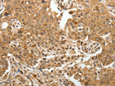 TFPI2 Antibody