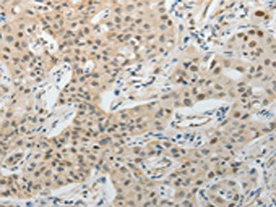 TFPI2 Antibody