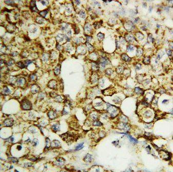 Anti-TFPI2 Antibody