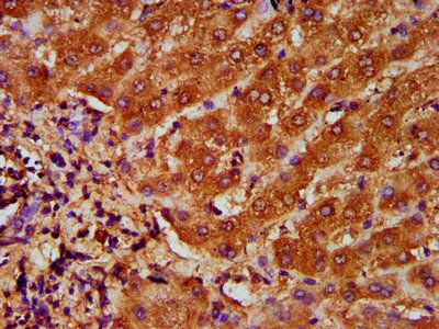 TFR2 Antibody