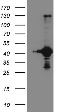 TGF beta Receptor II (TGFBR2) antibody