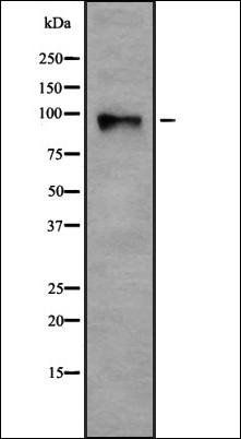 TGF beta Receptor III antibody