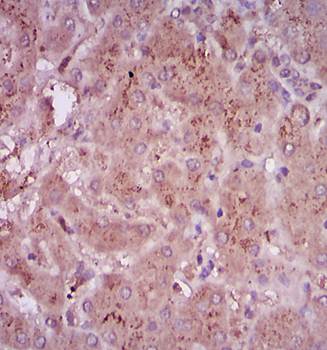 TGF beta 1 antibody