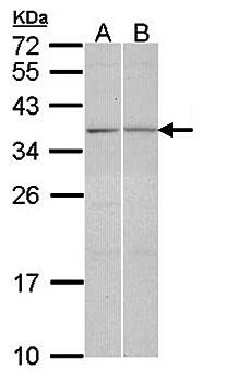 TGF beta induced factor 2 antibody