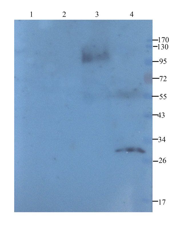 TGF beta Receptor 2 antibody