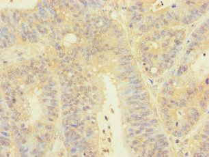 TGFB3 Antibody