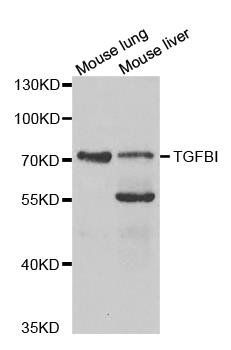 TGFBI antibody
