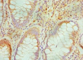TGFBI Antibody