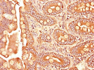 TGFBR1 Antibody