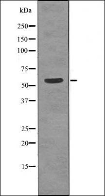 TGFBR1 (Phospho-Thr204) antibody