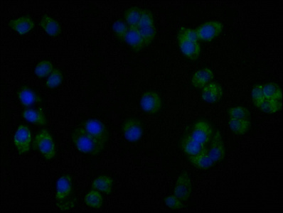 TGFBR3L antibody