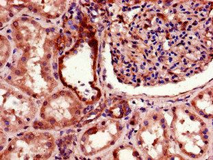 TGFBRAP1 Antibody