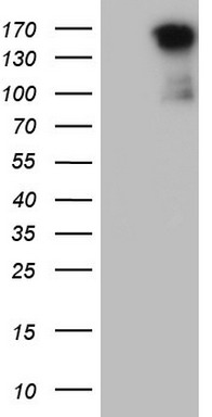 TGIF (TGIF1) antibody