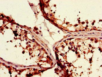 TGIF1 Antibody