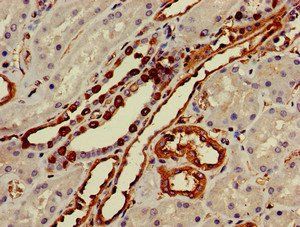 TGIF2 Antibody