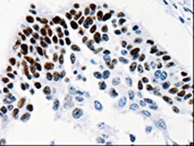 TGIF2LX Antibody