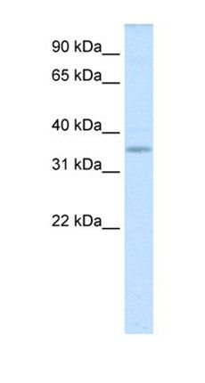 Tgif2lx1 antibody