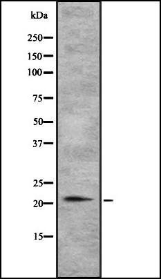 TGIF2LY antibody