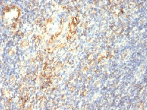 Transglutaminase II (TGM2) Antibody
