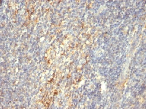 Transglutaminase II (TGM2) Antibody