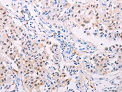TGM2 Antibody