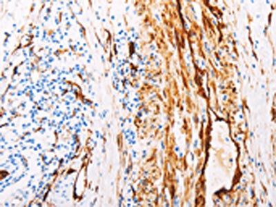 TGM2 Antibody