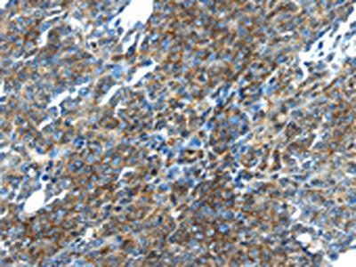 TGM5 Antibody