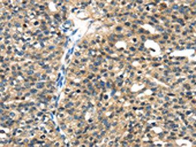 TGM5 Antibody