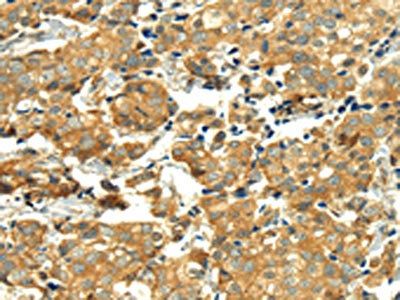 TGM5 Antibody