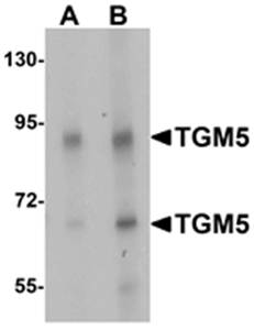 TGM5 Antibody