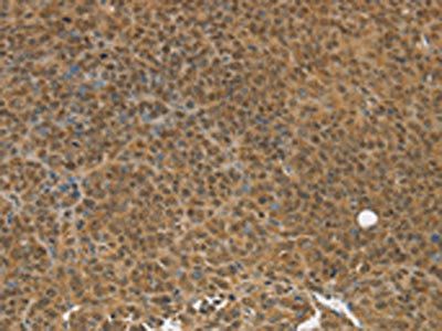 TGM7 Antibody