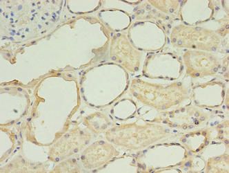 TGS1 Antibody