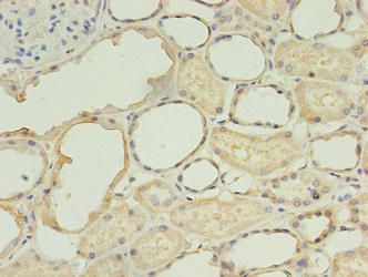 TGS1 antibody