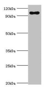 TGS1 antibody