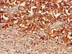 TH Antibody