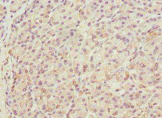 THADA Antibody