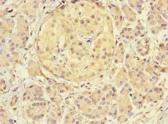 THADA Antibody
