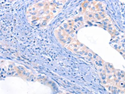 THBS1 Antibody