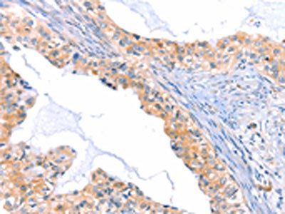 THBS1 Antibody