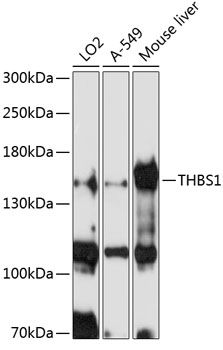 THBS1 antibody