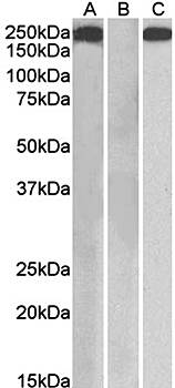 Goat anti-Thrombospondin (internal) Antibody