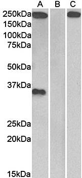 Goat anti-Thrombospondin Antibody
