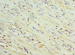 THBS3 Antibody
