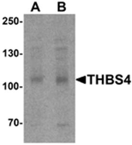 THBS4 Antibody